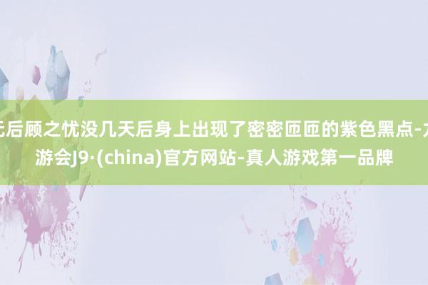无后顾之忧没几天后身上出现了密密匝匝的紫色黑点-九游会J9·(china)官方网站-真人游戏第一品牌